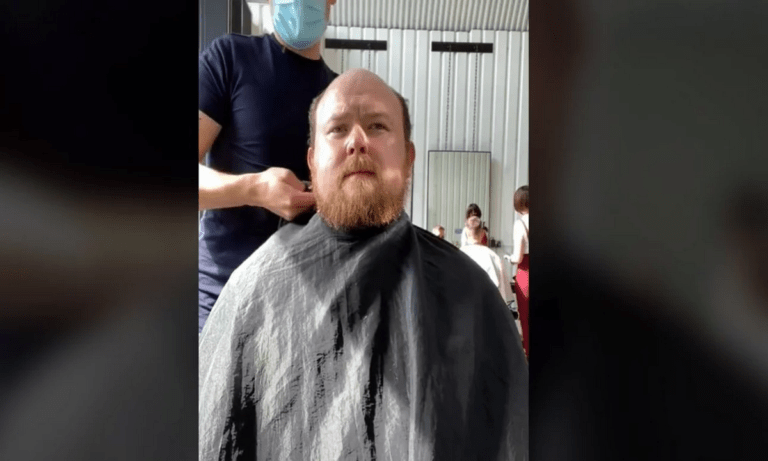 Viral: Απίστευτη αντίδραση άνδρα που απέκτησε ξανά μαλλιά μετά από 10 χρόνια! (vid)