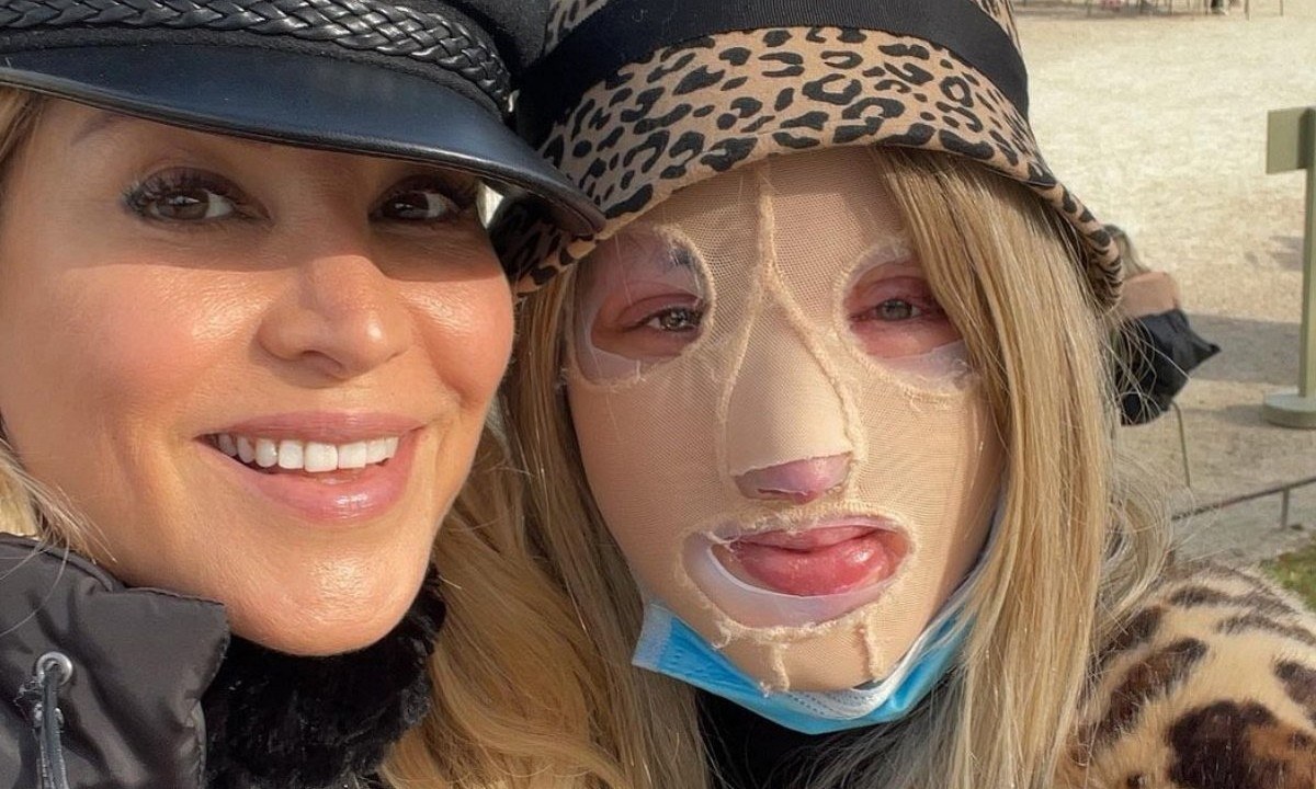 Επίθεση με βιτριόλι: Η Αννίτα Ναθαναήλ αποκάλυψε τη φιλία της με την Ιωάννα - Η φωτογραφία που δημοσίευσε